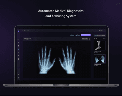 enhanced-pacs-system-img